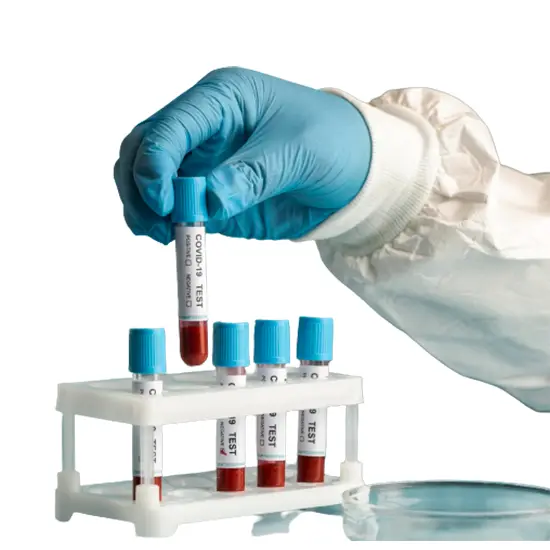 Malarial Falciparum and Vivax Antigen (Parasite V and F)